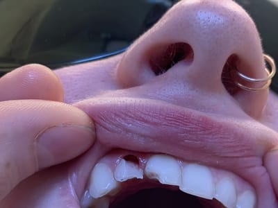 Burlington Family Dentistry