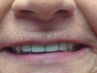 Burton Family Dentistry