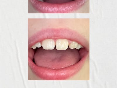 Cache Valley Dental Associates