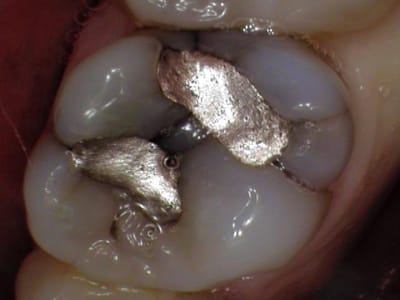 Cache Valley Dental Associates