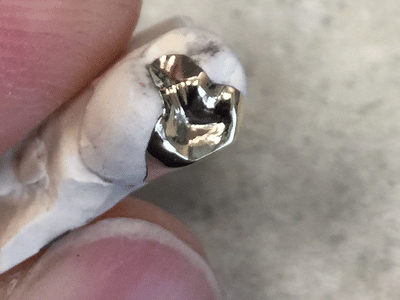 Cache Valley Dental Associates