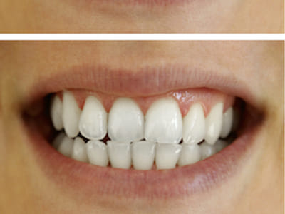 Caring Family Dentistry - Dentist in Tampa