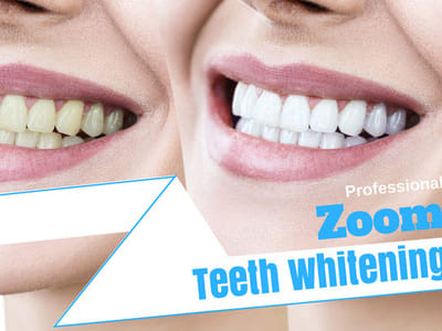 Caring Family Dentistry - Dentist in Tampa