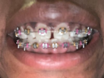 Center For Modern Dentistry