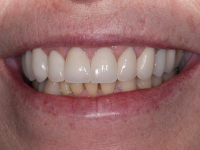 Central Coast Dental Care