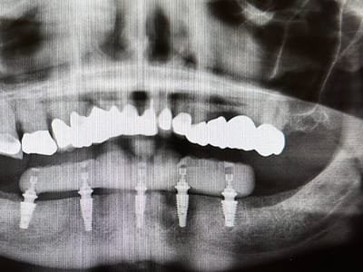 Central Coast Dental Care