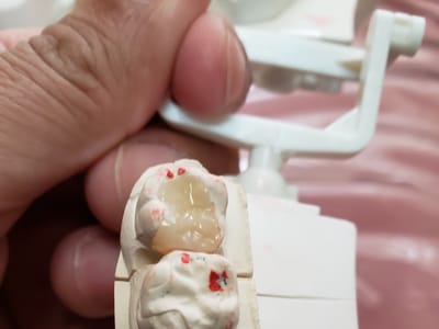 Central Dental Care : Dr. Celia P. Octoman DDS (Los Angeles)