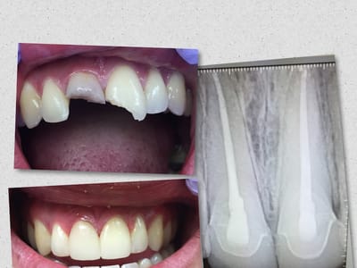 Central Valley Dentistry