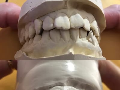 Central Valley Dentistry