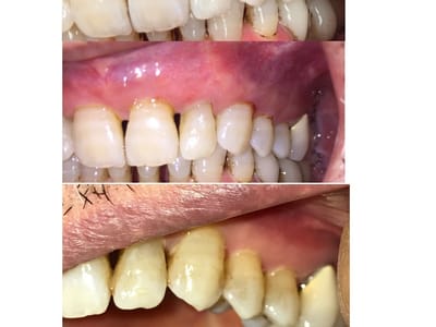 Central Valley Dentistry