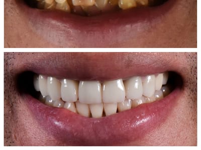 Clearview Dental Of Round Rock