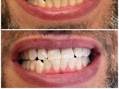 Clifton Park Family Dentistry