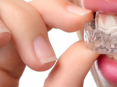 Columbine Creek Dentistry - Dentist Littleton