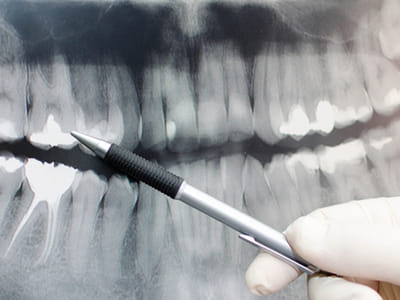 Comfort Care Dental - Rexburg