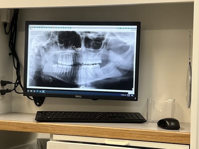 Comfort Dental Commerce City - Your Trusted Dentist in Commerce City