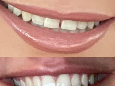 Comfort Dental Evergreen - Your Trusted Dentist in Evergreen