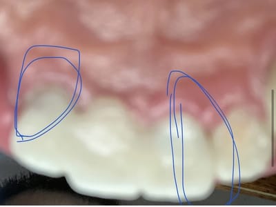 Comfort Dental Tower Road - Your Trusted Dentist in Aurora