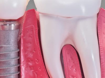 Comfy Smile Dental - Dentist Davie FL