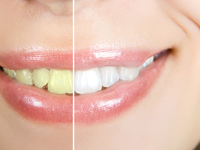 Community Family Dentistry