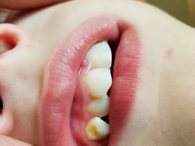 Community Health Center