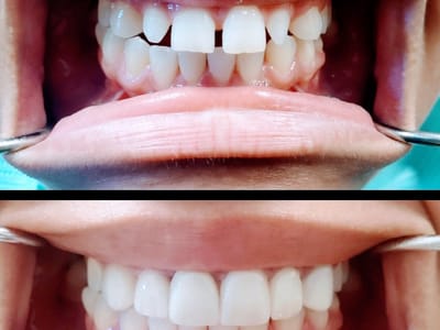 Complete Dental Care