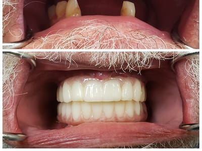 Complete Dental Care