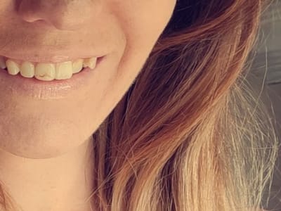 Complete Dental Care