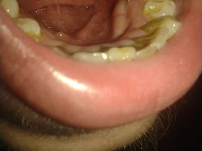 Complete Dental Care