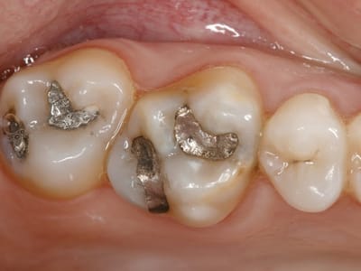 Complete Family Dentistry