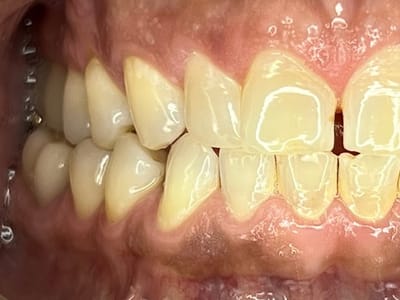 Comprehensive Family Dentistry