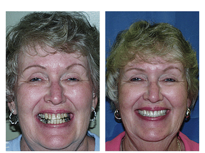 Contemporary Dentistry