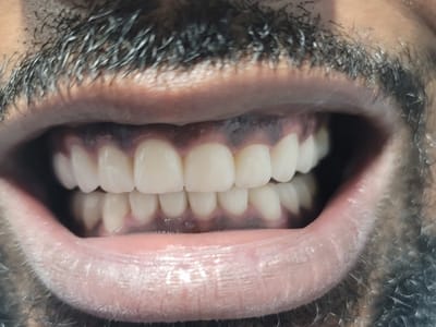 Coral Springs Smiles Dentistry