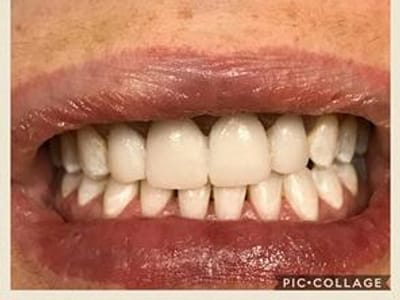 Cosmetic and Family Dentistry of Las Colinas