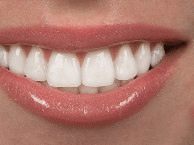 Cypress Rosehill Family Dentistry