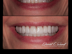 David C. Wood Family & Cosmetic Dentistry