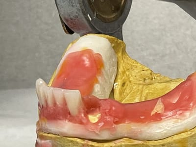 Day One Dentures & Implants (formerly Hauffe Dental)