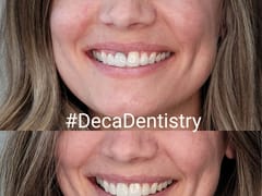 Deca Dentistry