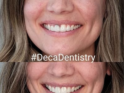 Deca Dentistry