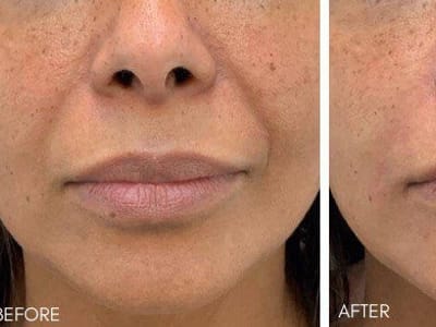 Dedicated Dental Group | Cosmetic & Laser Dentistry Parkland