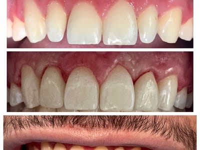 Dedicated Dental Group | Cosmetic & Laser Dentistry Parkland