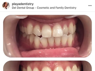 Del Dental Group - Shahrzad Fattahi Zarrinnam DDS