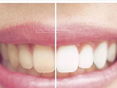 Del Dental Group - Shahrzad Fattahi Zarrinnam DDS