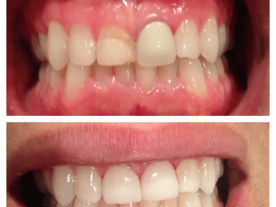 Del Dental Group - Shahrzad Fattahi Zarrinnam DDS