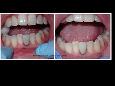 Denta Dental of Hobbs