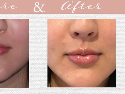 Denta Dental Of Odessa