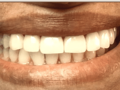 Denta Dental Of Odessa