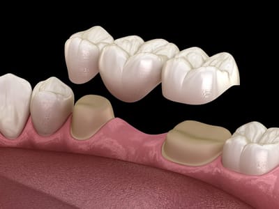 Dental 360 PC