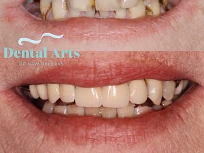 Dental Arts of New Orleans