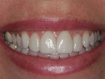 Dental Care Associates: Nathan Deeter DDS