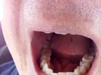 Dental Care at Dr. Phillips